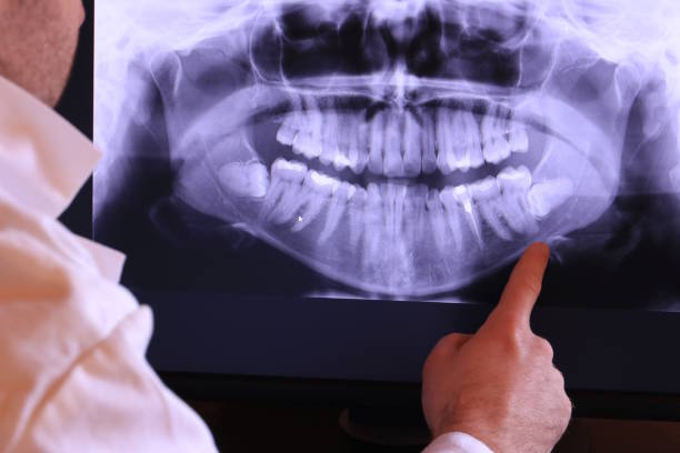 Best Emergency Wisdom Teeth Removal in Green Valley, MD