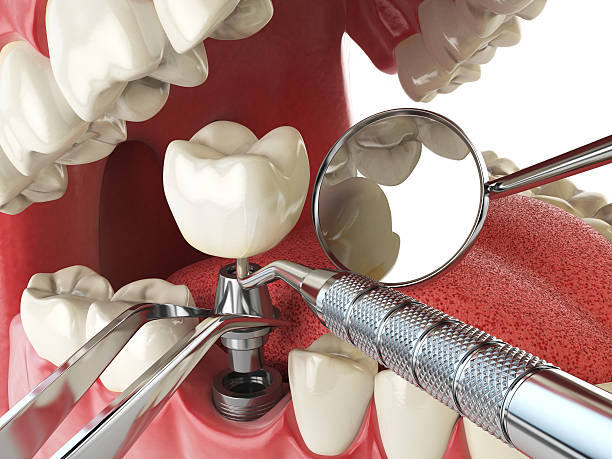 Best Emergency Treatment for Toothache in Green Valley, MD